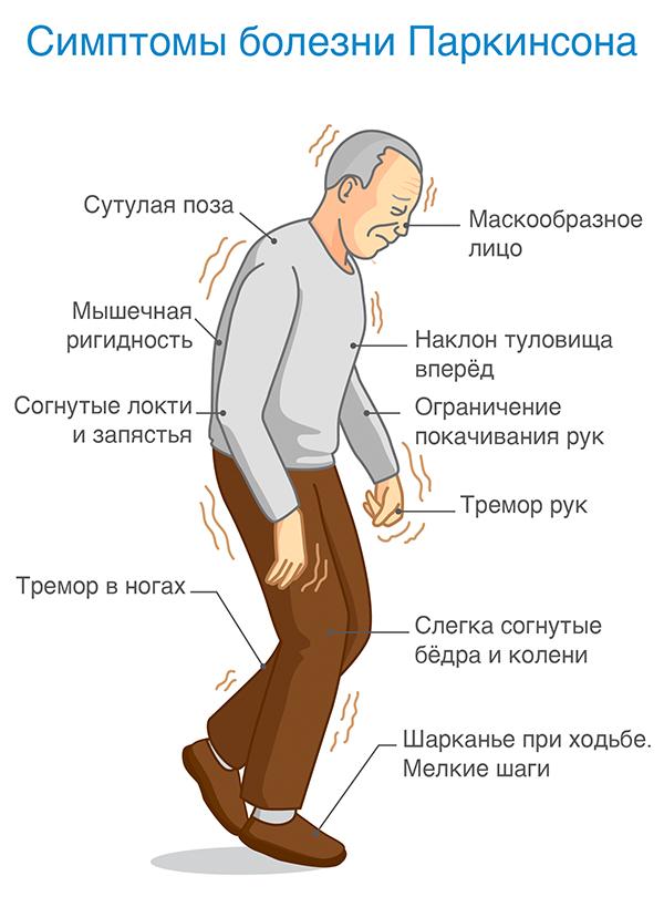 Уход за пожилыми с болезнью Паркинсона 